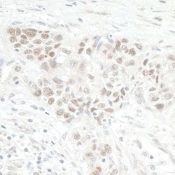 NOL12 Antibody, Novus Biologicals 0.1mg; Unlabeled:Antibodies, Polyclonal